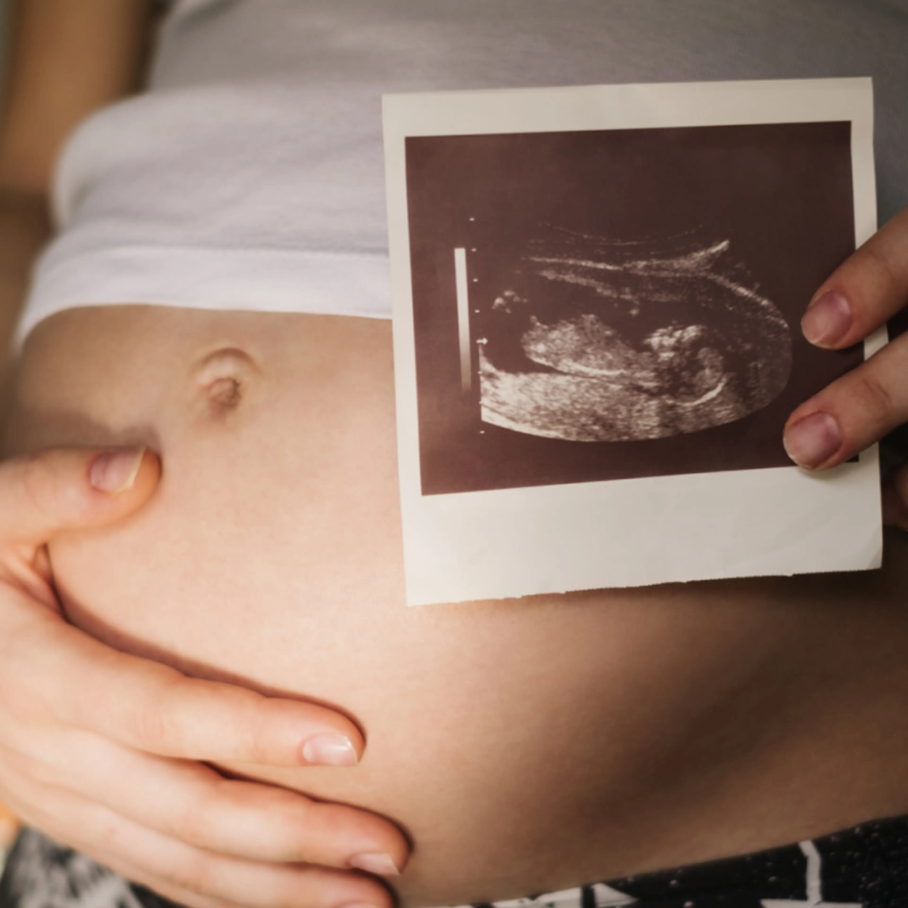 What To Eat Before A Gestational Diabetes Test what-to-eat-before-a-gestational-diabetes-test